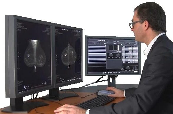 Station de diagnostic MedMammo avec deux écrans 5 MP
